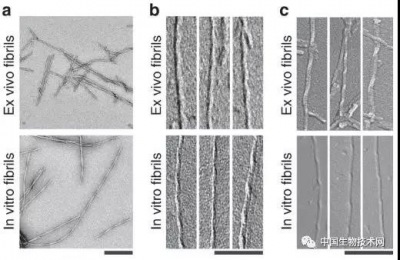 阿爾茨（cí）海默症研究（jiū）：β澱粉樣（yàng）蛋白原纖維（wéi）結構（gòu）揭開